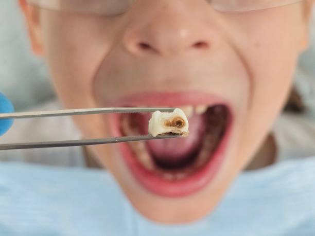 Best Weekend Emergency Dentist in Redwater, TX